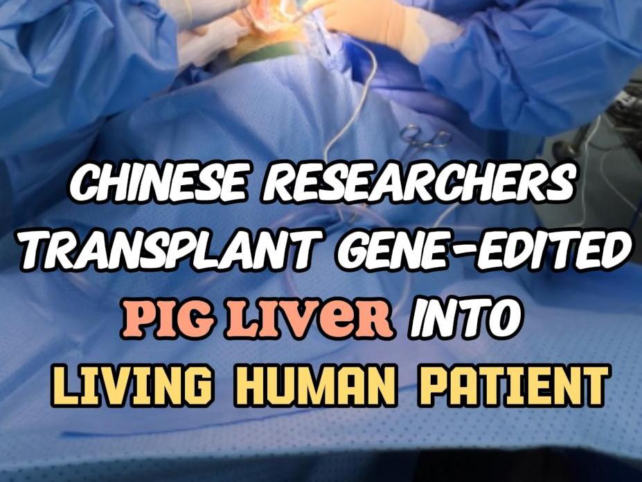 Xinhua news chinese researchers transplant gene edited pig liver into